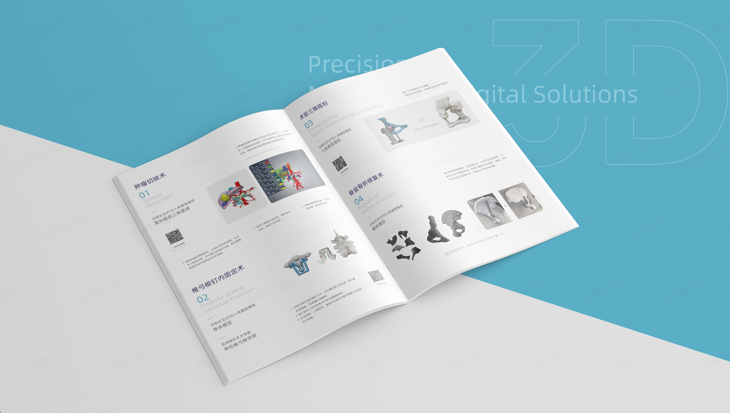 宣傳畫冊設計,畫冊制作,醫(yī)療畫冊,蘇州,無錫,常州,南通,泰州,張家港,江陰,太倉,昆山,常熟,靖江,設計公司,杉諦增材 
